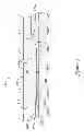 Fig. 06 - PRESSURE SENSING GUIDEWIRE