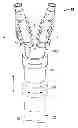 Fig. 01 - Catheter assembly with replaceable components