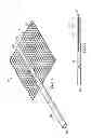 Fig. 02 - System for percutaneously administering reduced pressure treatment using balloon dissection