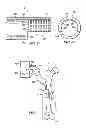 Fig. 06 - System for percutaneously administering reduced pressure treatment using balloon dissection