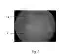 Fig. 06 - Patterned Laser Treatment