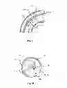 Fig. 06 - Tissue slitting methods and systems