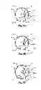 Fig. 07 - Tissue slitting methods and systems