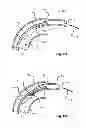 Fig. 08 - Tissue slitting methods and systems