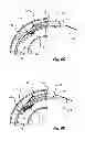 Fig. 09 - Tissue slitting methods and systems