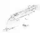 Fig. 02 - Bladder denervation for treating overactive bladder