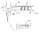 Fig. 01 - Methods and apparatus for renal neuromodulation
