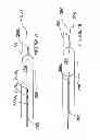 Fig. 09 - Methods and apparatus for renal neuromodulation