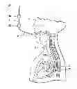 Fig. 01 - Method and apparatus for performing transesophageal cardiovascular procedures