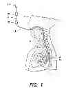 Fig. 02 - Method and apparatus for performing transesophageal cardiovascular procedures