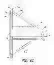 Fig. 08 - Method and apparatus for performing transesophageal cardiovascular procedures