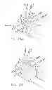 Fig. 45 - Orthopedic device