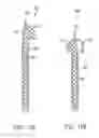 Fig. 08 - Low profile reamers and methods of use