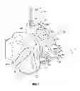 Fig. 02 - Patient-specific orthopedic instruments