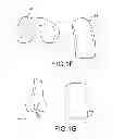 Fig. 08 - Unicompartmental customized arthroplasty cutting jigs