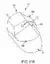 Fig. 28 - Unicompartmental customized arthroplasty cutting jigs