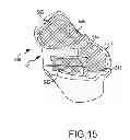 Fig. 32 - Unicompartmental customized arthroplasty cutting jigs