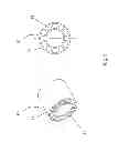 Fig. 09 - Method and apparatus for delivering cement paste into a bone cavity