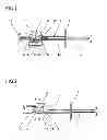 Fig. 02 - Intraocular lens inserting instrument