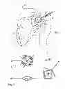 Fig. 02 - Method and devices for implantation of biologic constructs