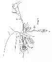 Fig. 08 - Closed system pneumatic impact lithotripsy