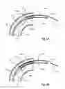 Fig. 07 - LEAD REMOVAL SLEEVE
