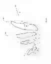 Fig. 158 - Robotic catheter system and methods