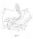 Fig. 331 - Robotic catheter system and methods