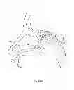 Fig. 362 - Robotic catheter system and methods
