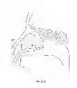 Fig. 366 - Robotic catheter system and methods