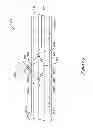 Fig. 06 - NERVE MODULATION SYSTEM