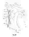 Fig. 04 - Tissue slitting methods and systems