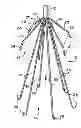 Fig. 01 - Removable embolus blood clot filter and filter delivery unit