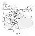 Fig. 08 - Anti-backup suture anchor