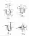 Fig. 02 - Self-cinching suture anchors, systems, and methods