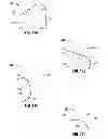 Fig. 08 - TISSUE ANCHOR APPLICATOR