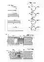 Fig. 06 - Crossbar spinal prosthesis having a modular design and related Implantation methods