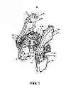 Fig. 02 - Spinous process fixation system and methods thereof