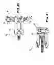 Fig. 45 - Spinous process fixation system and methods thereof