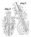 Fig. 04 - Dynamic stabilization medical implant assembles and methods