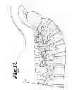 Fig. 08 - Dynamic stabilization medical implant assembles and methods