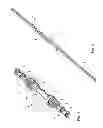 Fig. 02 - Sternal plate type sternal closure comprising an integral severing site member