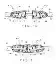 Fig. 06 - Apparatus and method for sternal closure