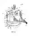 Fig. 04 - Method for treating hypertension via electrical stimulation of neural structures