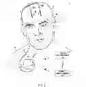 Fig. 02 - ASSIGNMENT AND MANIPULATION OF IMPLANTABLE LEADS IN DIFFERENT ANATOMICAL REGIONS WITH IMAGE BACKGROUND