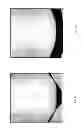 Fig. 06 - ENHANCED LIGHT BASED LIPOPLASTY