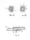 Fig. 06 - Multi-durometer reinforced suture sleeve