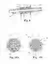 Fig. 07 - Multi-durometer reinforced suture sleeve