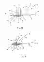 Fig. 02 - MEDICAL DEVICE ANCHORING SYSTEMS AND METHODS