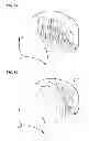 Fig. 09 - HEADACHE-TREATMENT DEVICE WITH GEL DISPENSING KIT AND METHOD